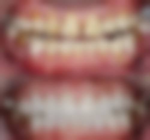 河南中 医 药大学第三附属医院修复科乔敏医生擅长项目