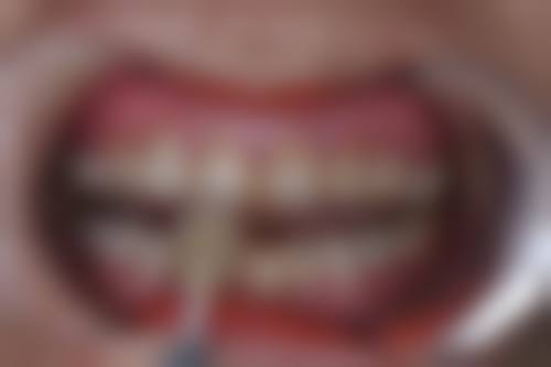 沭阳中兴医院乔敏医生擅长项目