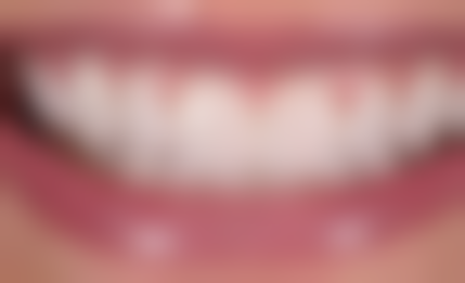 齐齐哈尔市中医医院李晓雯医生怎么预约挂号