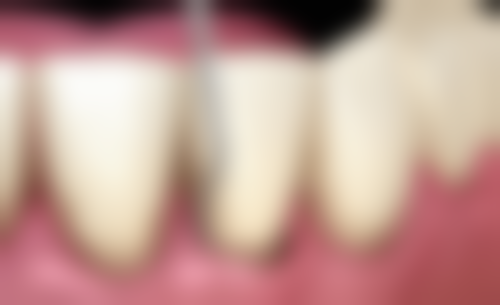 临沂惠泽口腔门诊部医院特色项目