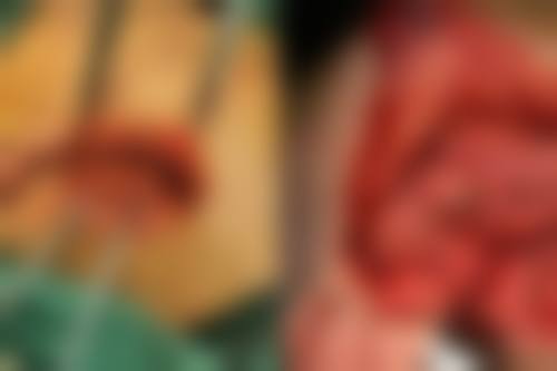 贵州医 科 大学附属医院李成龙医生怎么预约挂号