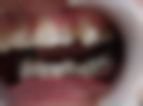 无锡爱思特整形沈晓一医生的收费价格表