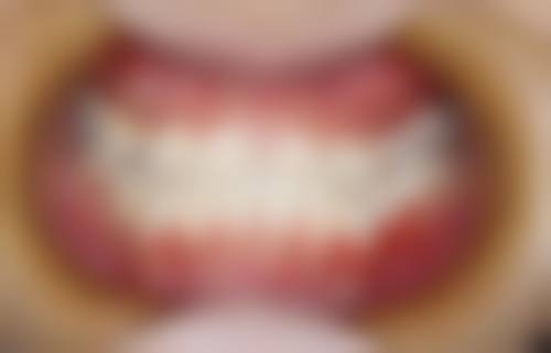 无锡爱思特整形沈晓一医生技术特色