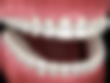 福建省浦城县医院孙新华医生技术特色