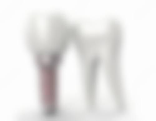 山东大学齐鲁医院张凯医生擅长项目