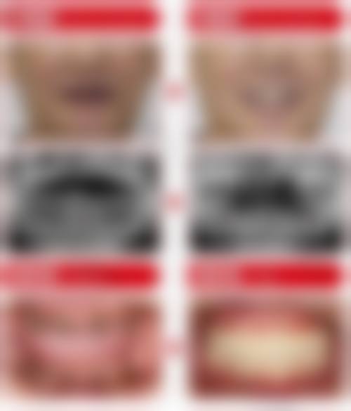 南京医 科 大学附属逸夫医院张凯医生技术特色