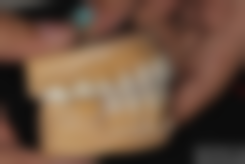 上海市东方医院张凯医生擅长项目