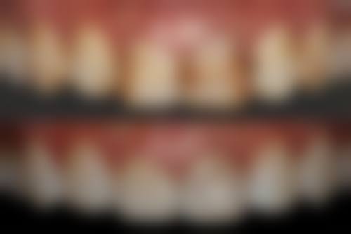 廊坊院区防癌体检中 心张凯医生的收费价格表