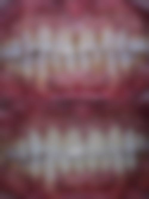 南京鼓楼医院张凯医生的收费价格表