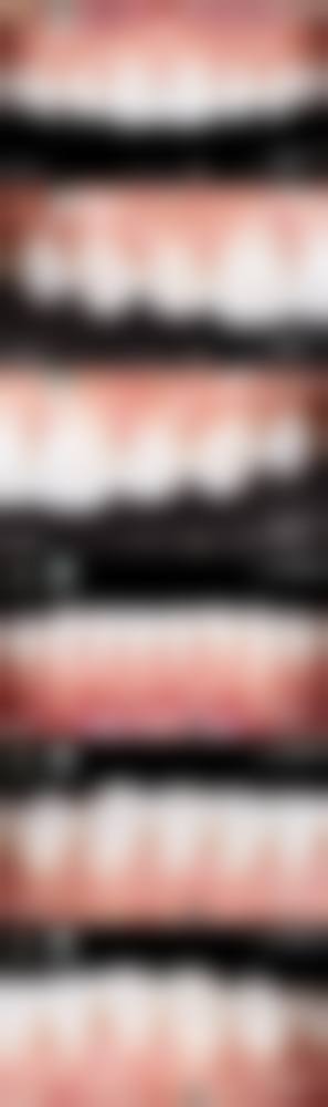 廊坊院区防癌体检中 心张凯医生技术特色