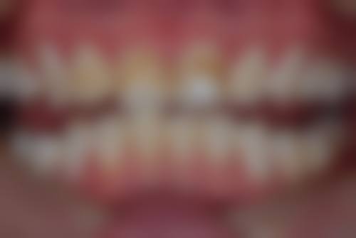 上海市东方医院张凯医生技术特色