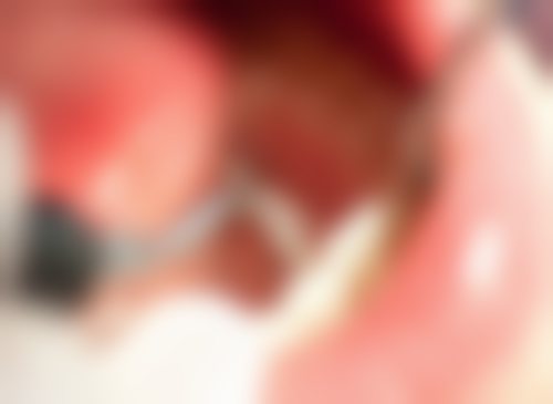 研究卵巢衰老机制何敏医生技术特色