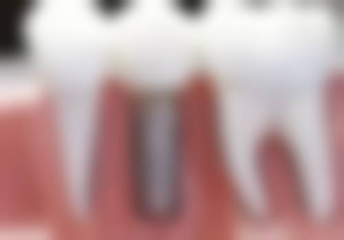 邳州市人民医院李荣华医生执业信息