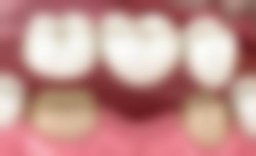 广西中 医 药大学附属瑞康医院李荣华医生擅长项目