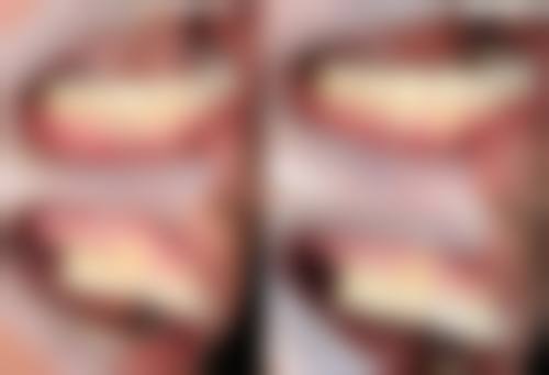 珠海市人民医院李荣华医生的收费价格表