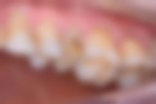 研究卵巢衰老机制何敏医生擅长项目