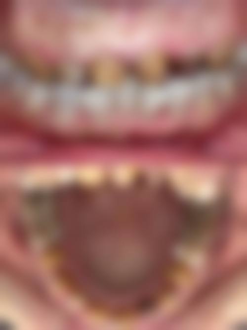 南京名喆口腔门诊部赵兵杰医生口碑评价