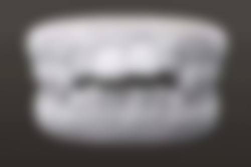 哈尔滨医 科 大学附属第二医院刘鸣医生技术特色