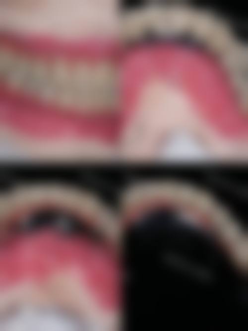 南京建邺润玺口腔门诊部李金鹏医生的收费价格表