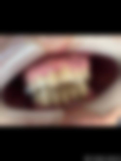 临沂市罗庄区黄山镇卫生院李金鹏医生怎么预约挂号