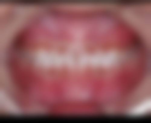 宿州市埇桥区褚兰镇卫生院刘鸣医生擅长项目