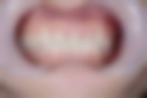 襄城县人民医院刘鸣医生技术特色