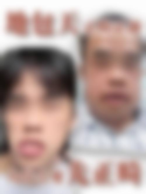 襄城县人民医院刘鸣医生擅长项目