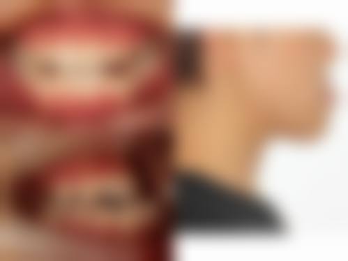 郑大一附院刘鸣医生的收费价格表