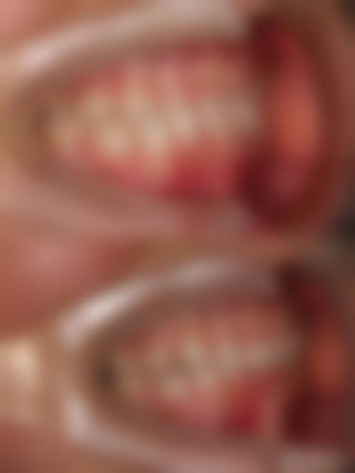 江苏省中医院刘鸣（高血压病科）医生技术特色