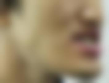 上海交通大学医学校附属新华医院刘鸣医生擅长项目