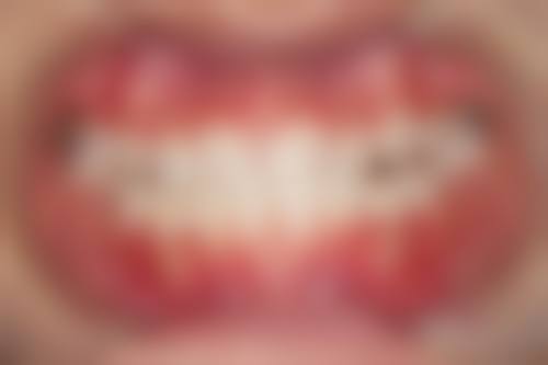 江苏省中医院刘鸣（心血管科）医生口碑评价