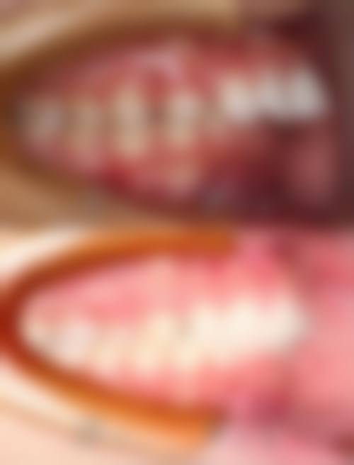 宿州市埇桥区褚兰镇卫生院刘鸣医生简介