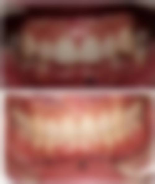 哈尔滨医 科 大学附属第二医院刘鸣医生的收费价格表