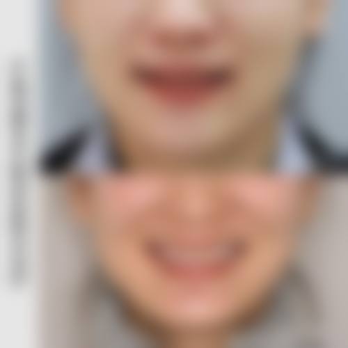 徐州鼎植口腔医院刘鸣医生的收费价格表