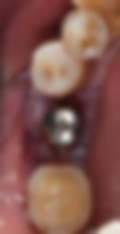 郑州德贝口腔李会龙医生怎么预约挂号