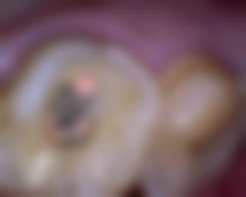 中日友好医院马丹丹医生怎么预约挂号