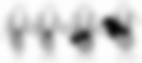 中日友好医院马丹丹医生擅长项目