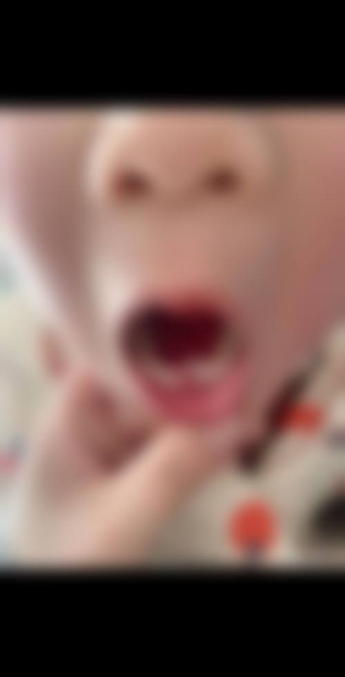 重庆美连口腔门诊部邓潘医生的收费价格表