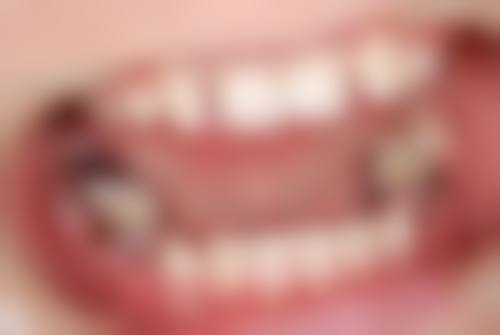 聊城市优美口腔诊所医院顾客的口碑评价