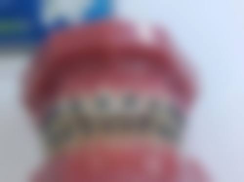 上海申洁口腔医院胡潇医生技术特色