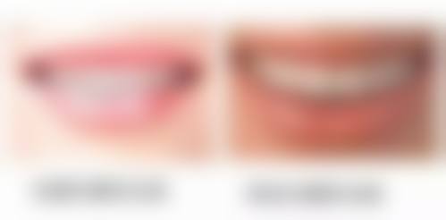 重庆市梁平区人民医院胡潇医生的收费价格表