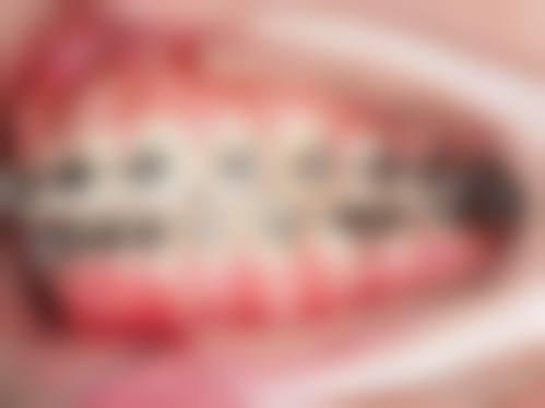 微山县人民医院胡潇医生怎么预约挂号