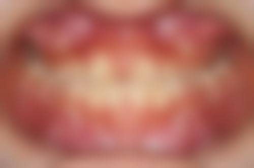 上海申洁口腔医院胡潇医生的收费价格表