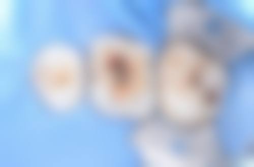 上海申洁口腔医院胡潇医生怎么预约挂号