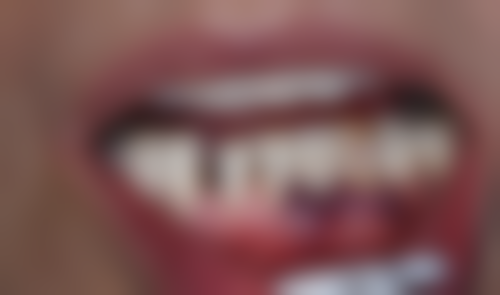 南京鼓楼医院王帅医生怎么预约挂号