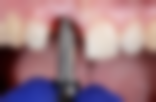 中日友好医院王帅医生怎么预约挂号