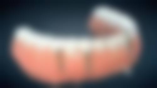 东莞大岭山好佰年领秀口腔门诊部汪芳医生口碑评价