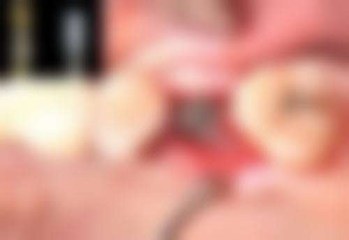 荆州市中 心医院王帅医生口碑评价