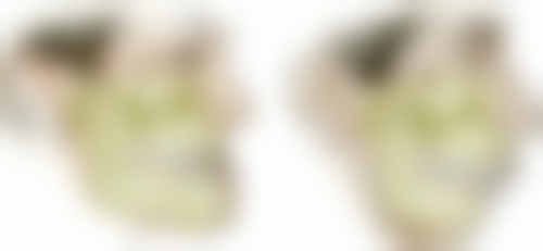 靖边县人民医院王彩荣医生口碑评价