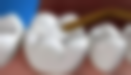 泉州市第一医院李荣华医生口碑评价